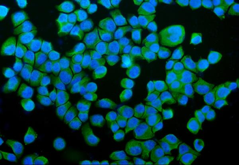 P4HB Antibody