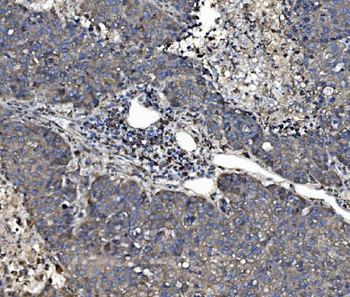 P4HB Antibody