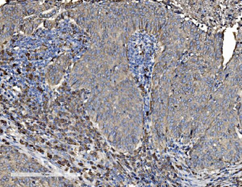 P4HB Antibody