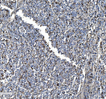 P4HB Antibody