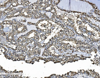 P4HB Antibody