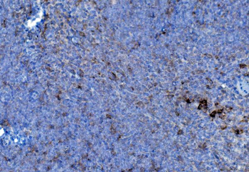 P4HB Antibody