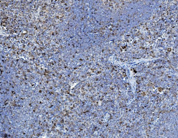 P4HB Antibody
