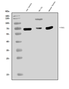 PAK1 Rabbit Polyclonal Antibody