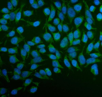 PFKFB2 Antibody