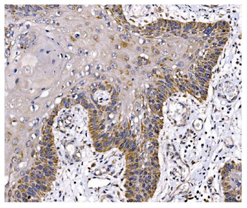 PFKFB2 Antibody