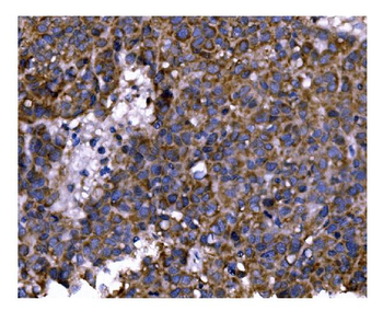PFKFB2 Antibody