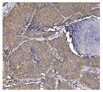 PFKFB2 Antibody