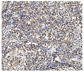 PFKFB2 Antibody