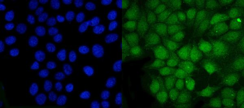 PSMB5/MB1 Antibody