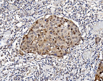PSMB5/MB1 Antibody