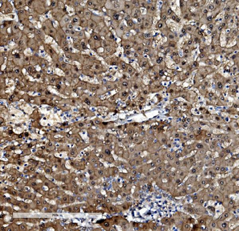 PSMB5/MB1 Antibody