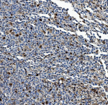 PSMB5/MB1 Antibody