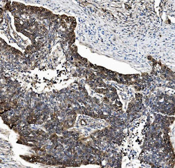 PSMB5/MB1 Antibody