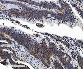 PSMB5/MB1 Antibody