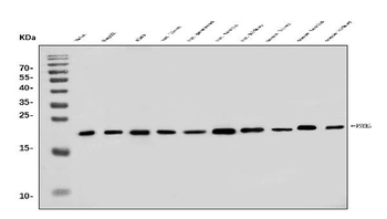 PSMB5/MB1 Antibody
