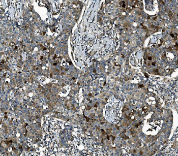 SEC14L3/TAP2 Antibody