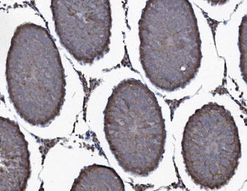 SEC14L3/TAP2 Antibody