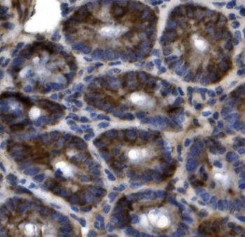 SLC44A2 Rabbit Polyclonal Antibody