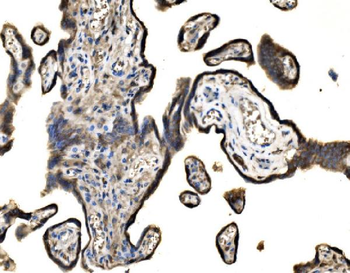 SND1 Rabbit Polyclonal Antibody