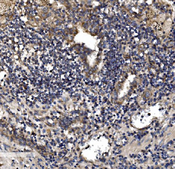Astrin/Deepest/SPAG5 Antibody
