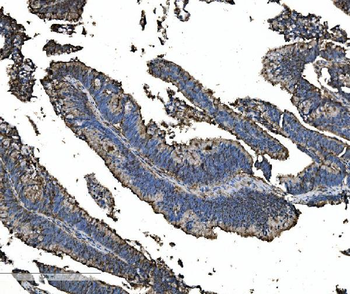Astrin/Deepest/SPAG5 Antibody