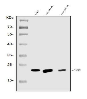 TAGLN/Transgelin Antibody