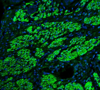 TAGLN/Transgelin Antibody