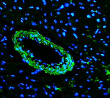 TAGLN/Transgelin Antibody