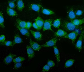 TAGLN/Transgelin Antibody