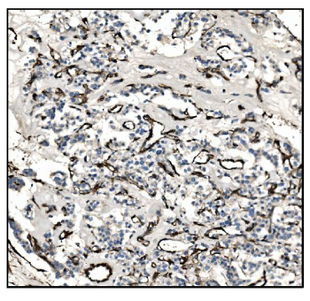 TAGLN/Transgelin Antibody