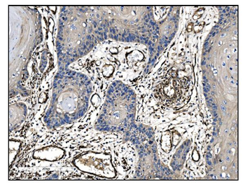 TAGLN/Transgelin Antibody