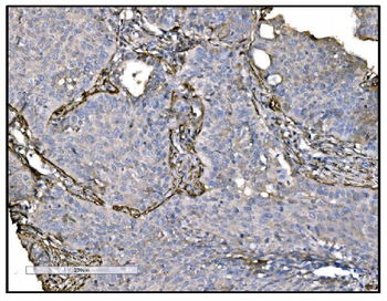 TAGLN/Transgelin Antibody