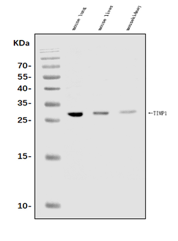 TIMP1 Rabbit Polyclonal Antibody