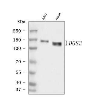 Desmoglein 3/DSG3 Rabbit Polyclonal Antibody