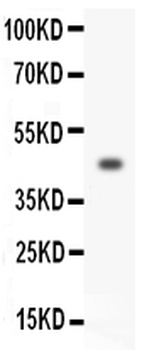 Homeobox protein Hox-A3 HOXA3/A3 Rabbit Polyclonal Antibody