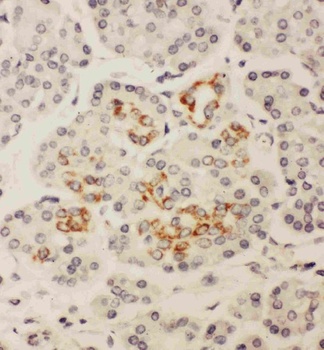 Homeobox protein Hox-A3 HOXA3/A3 Rabbit Polyclonal Antibody