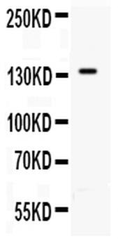 CD62P/SELP Rabbit Polyclonal Antibody