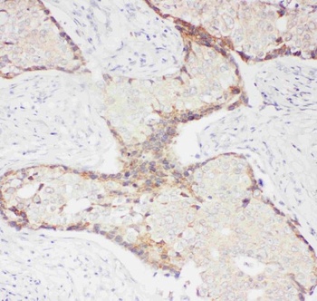 CD62P/SELP Rabbit Polyclonal Antibody