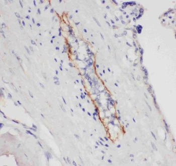 CD62P/SELP Rabbit Polyclonal Antibody