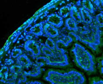 CD147/Bsg Antibody