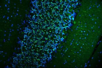 CAMKIV/Camk4 Antibody