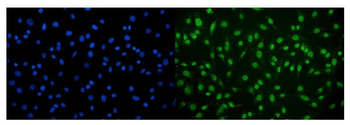CAMKIV/Camk4 Antibody