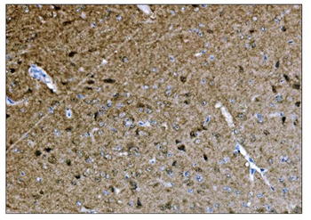 CAMKIV/Camk4 Antibody