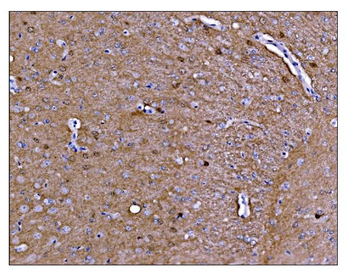 CAMKIV/Camk4 Antibody