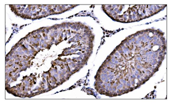 CAMKIV/Camk4 Antibody