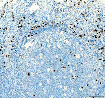 CTLA4 Antibody