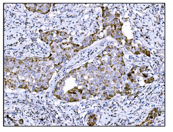 DLGAP1 Antibody