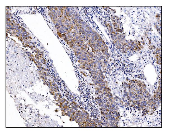 DLGAP1 Antibody