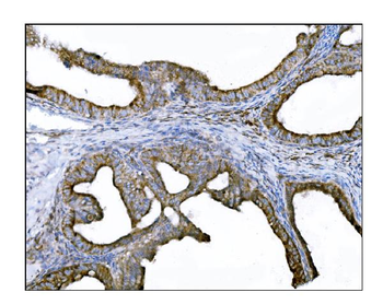 DLGAP1 Antibody